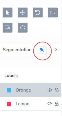 The wand icon to activTE Magic Segment